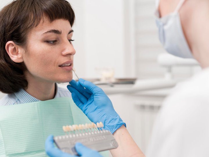 Як обрати правильний відтінок вінірів для ідеальної посмішки