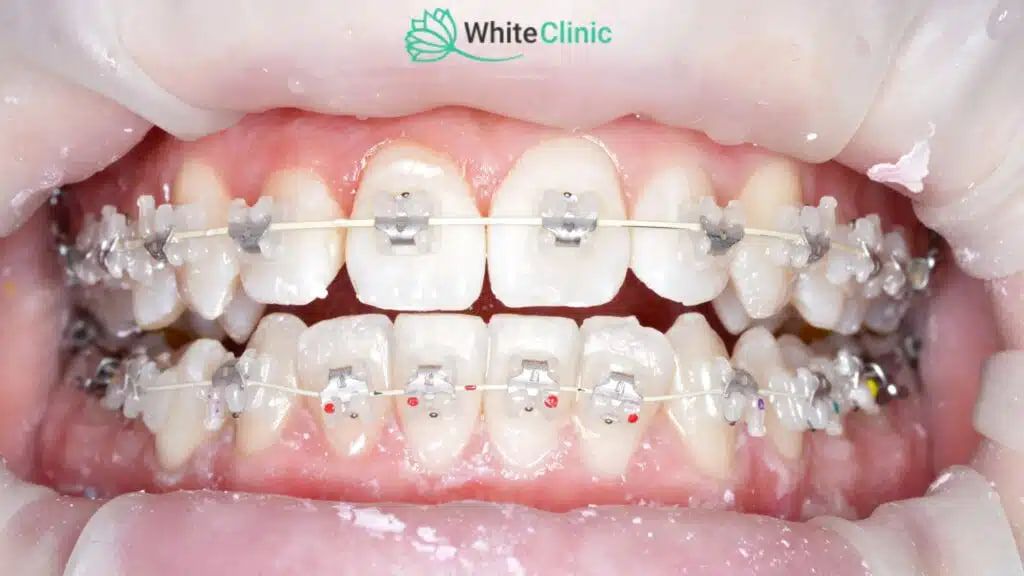 Photo 2025 09 26 14 44 44