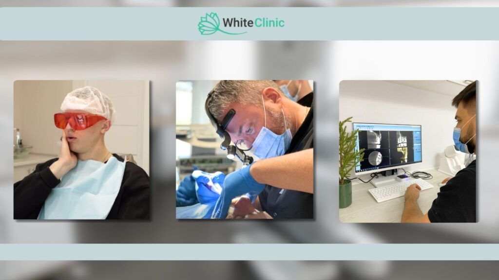 Pidgotovka Do Vydalennja Zuba Mudrosti 1024x576