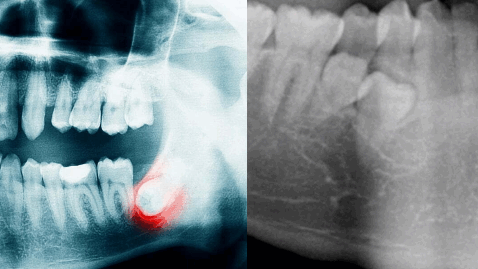 Retenovaniy 1536x864