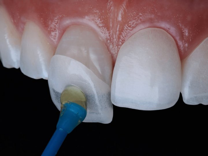 Що таке люмініри?