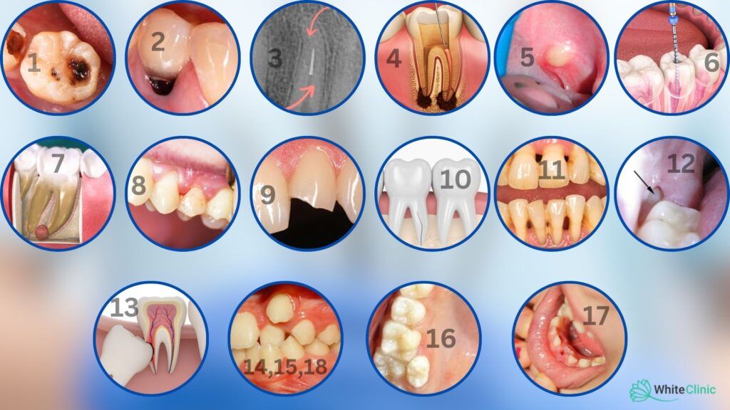 Reasons for Tooth Extraction 1024x576