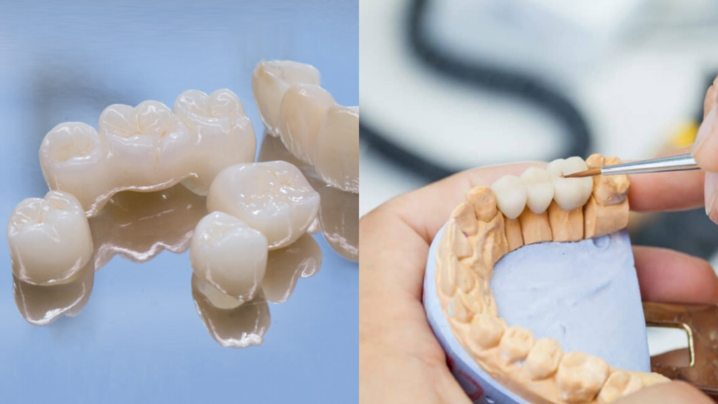 Koronki Dlya Zubov 1024x576