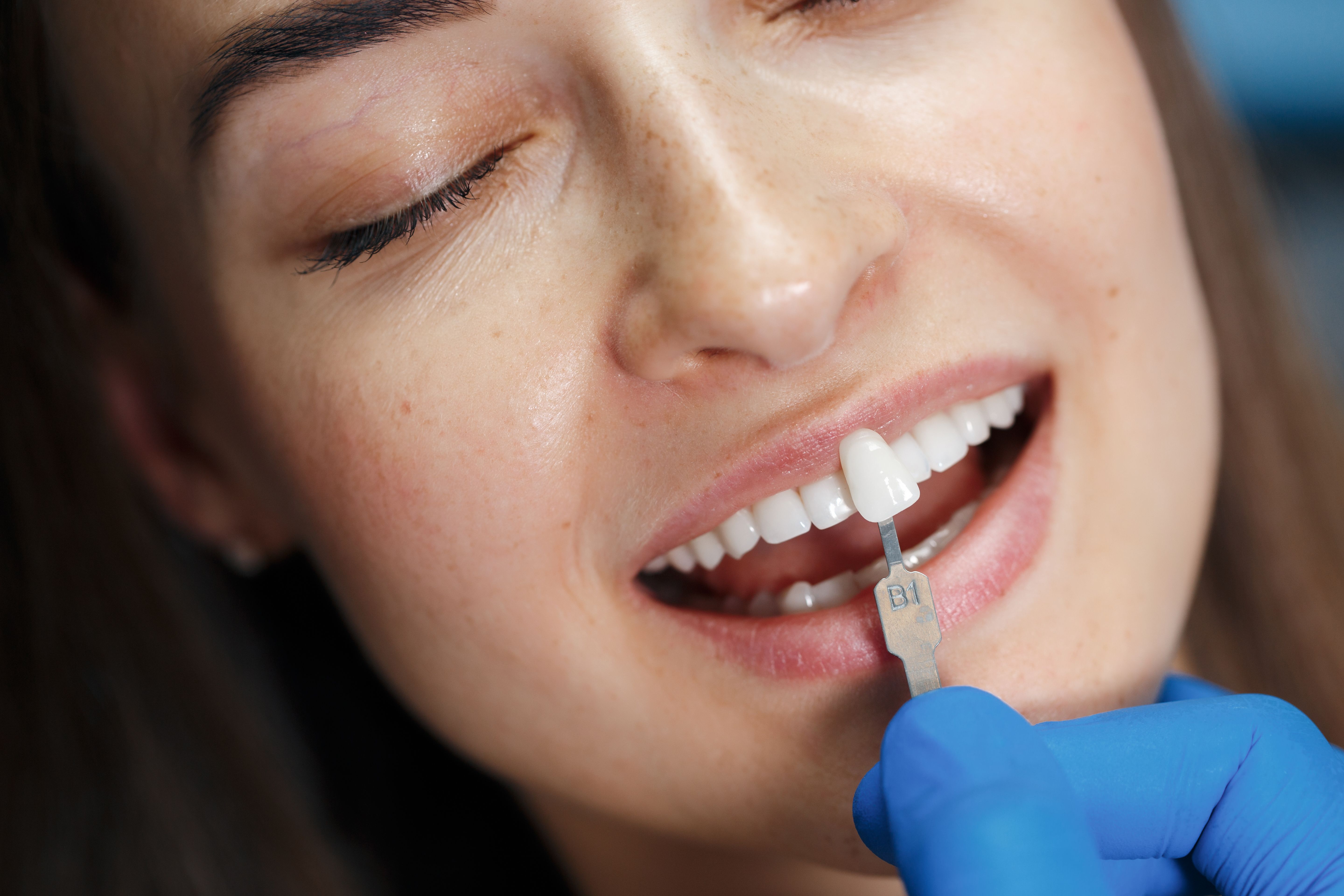 Dentist White Teeth