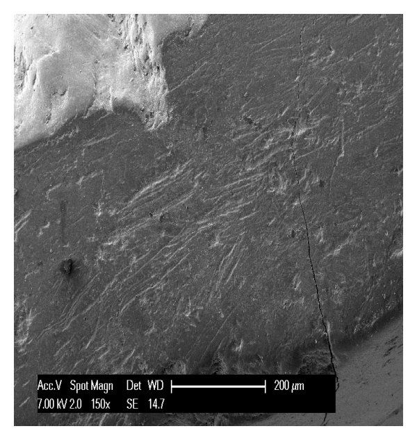 Scratches Stripes and Striations Cover the Surface of Enamel Affected by Attrition