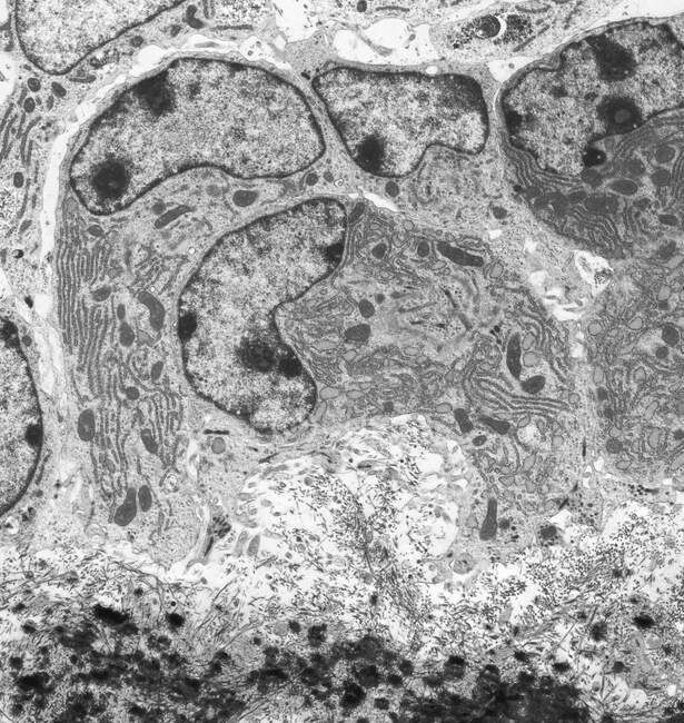 Focused 463649600 Stock Photo Osteoblasts Colored Transmission Electron Micrograph