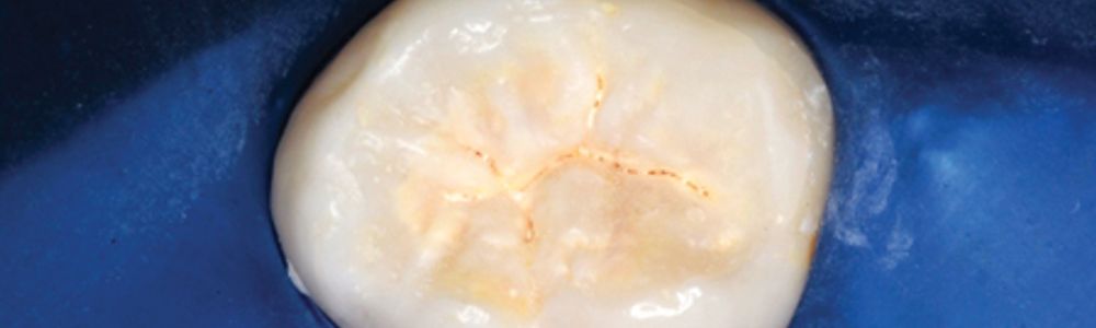 Berg Fig 1