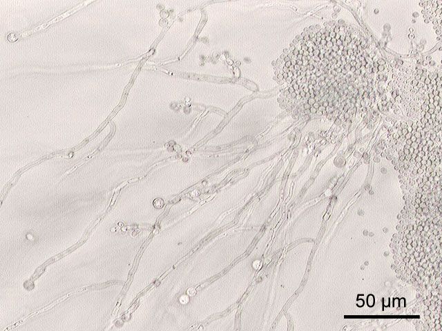 Candida Albicans