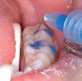 Photo 2025 09 02 11 29 39