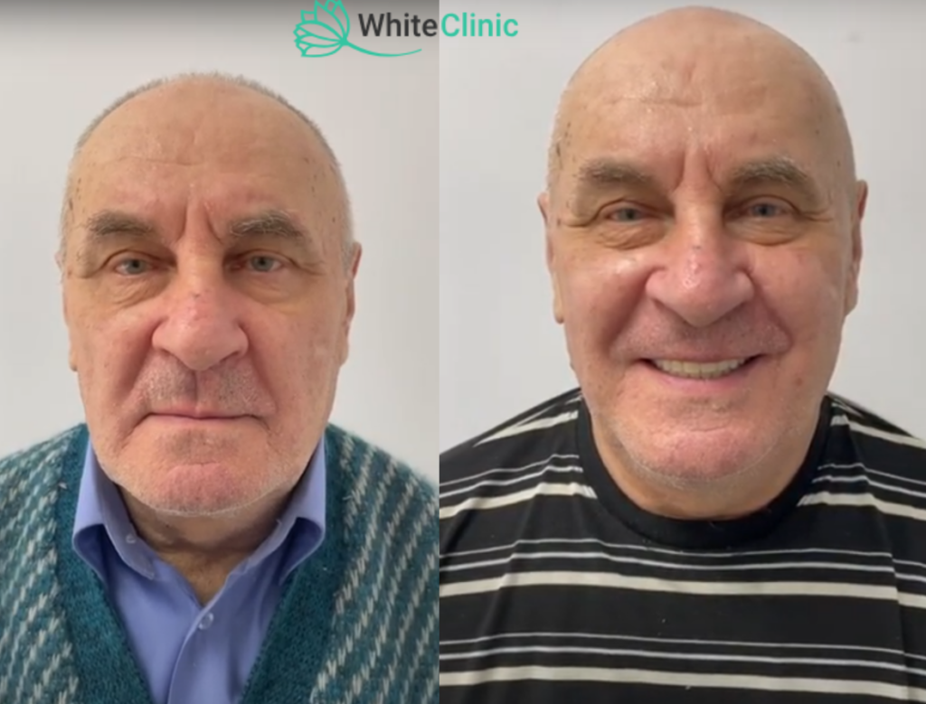 Protezuvanya 1024x779