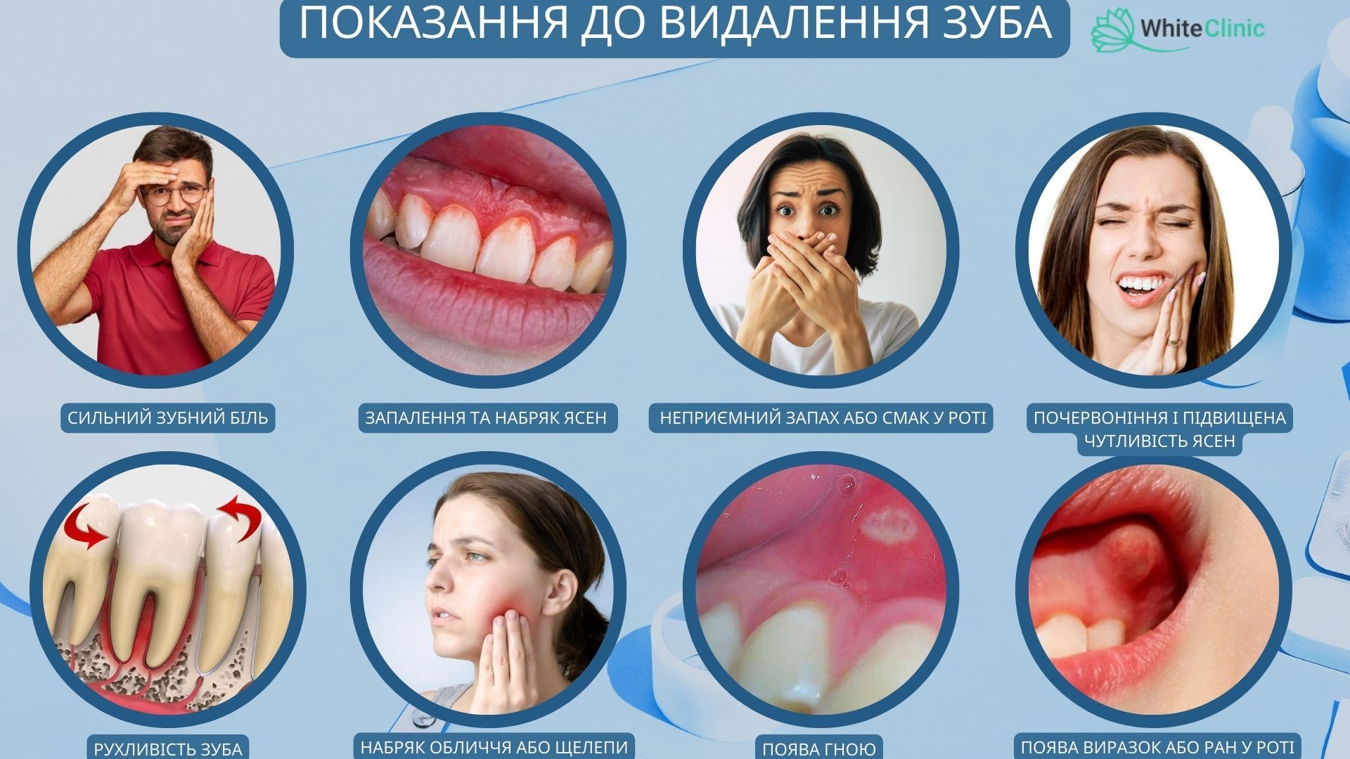 Indications for Tooth Extraction