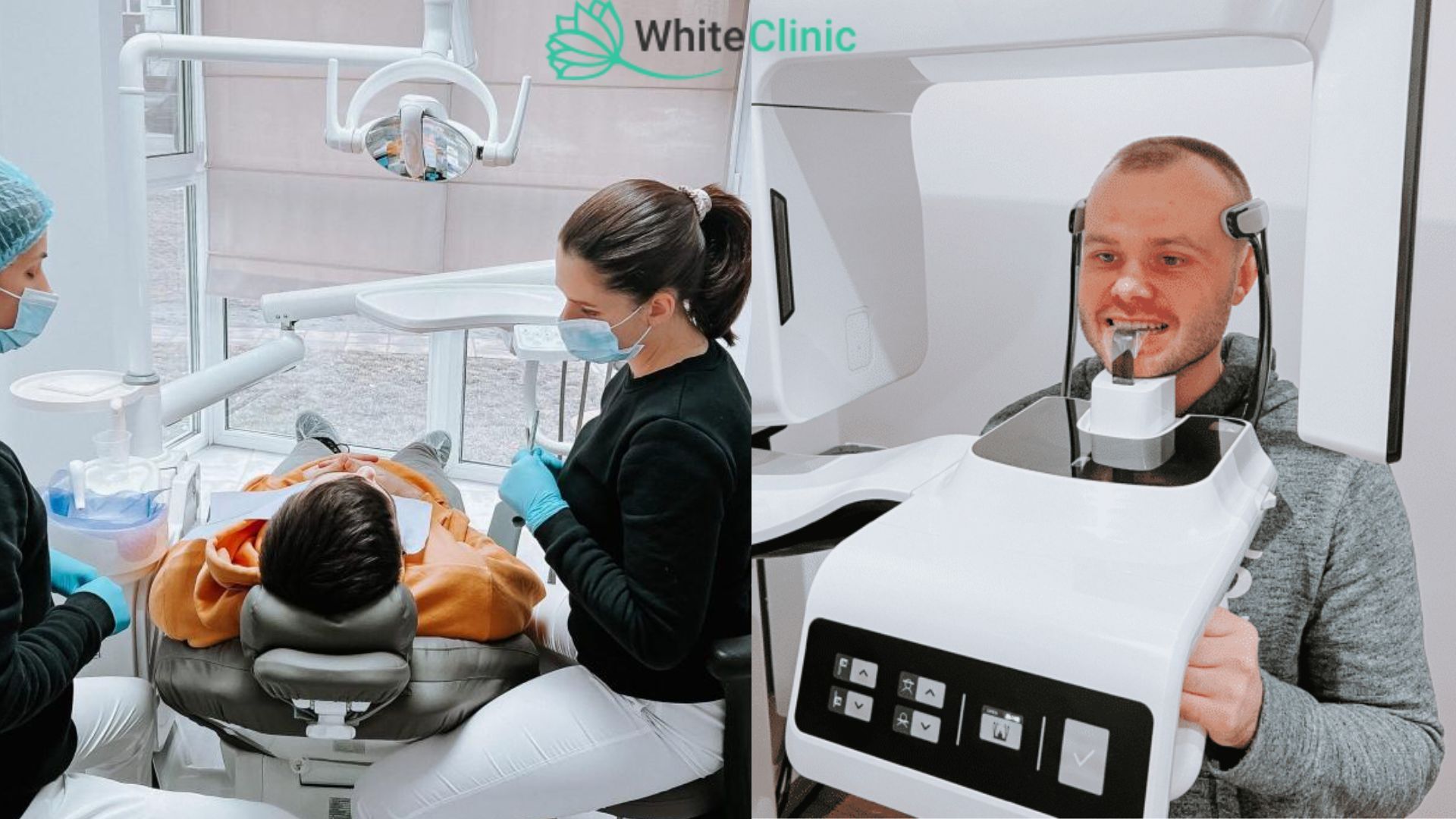 Koly Potribno Vydaljaty Zuby Mudrosti